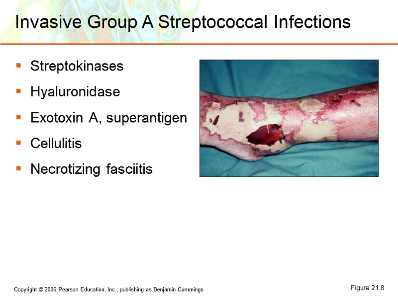 Invasive Group A Streptococcal Infections Streptokinases Hyaluronidase Exotoxin A, superantigen Cellulitis Necrotizing fasciitis Figure